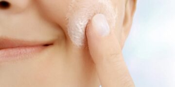 Чому лущиться шкіра після застосування кислот і як цього уникнути